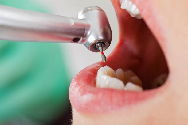 Best Emergency Dental Services for Seniors in Redwood, TX